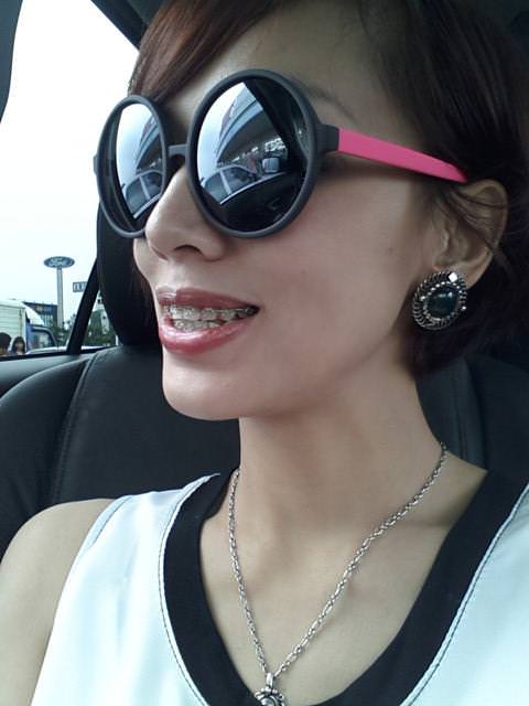 牙套生活-首部曲