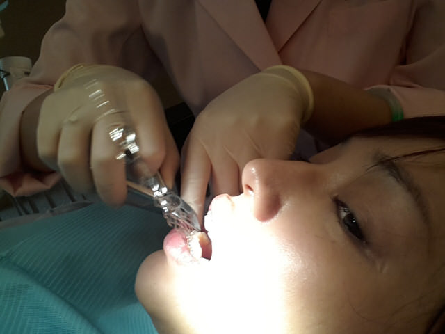 牙套生活-首部曲