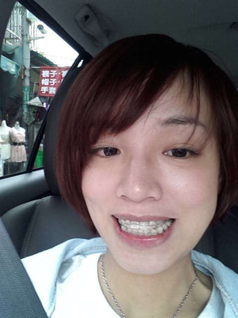 牙套生活-首部曲