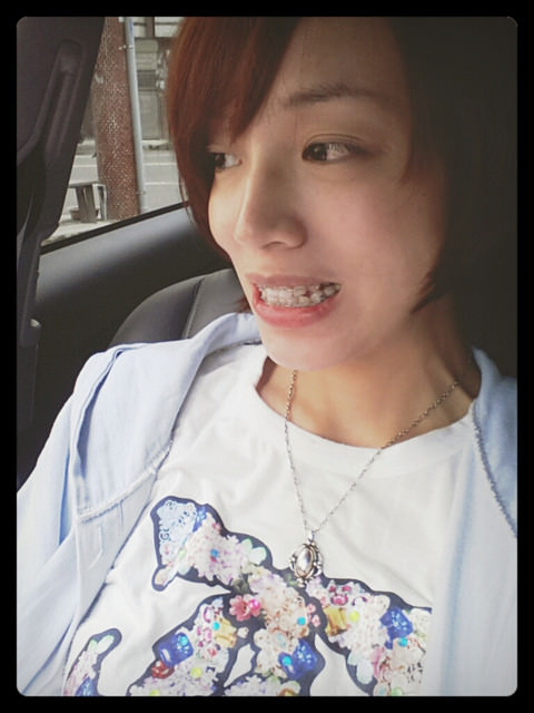 牙套生活-首部曲